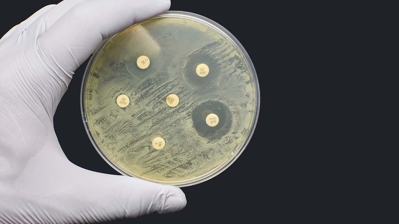 amr-resistance