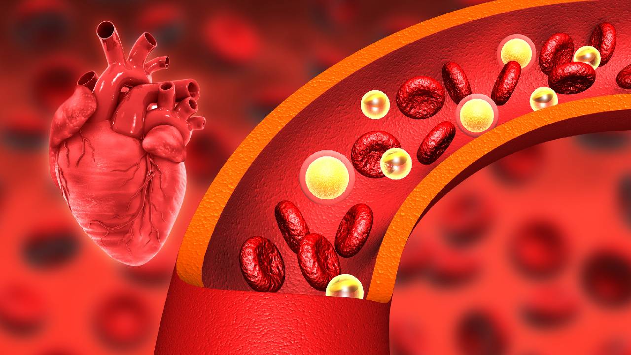 cvd-clogged-arteries-heart1-summary